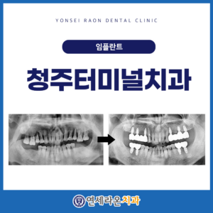 청주터미널치과