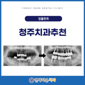 청주치과추천
