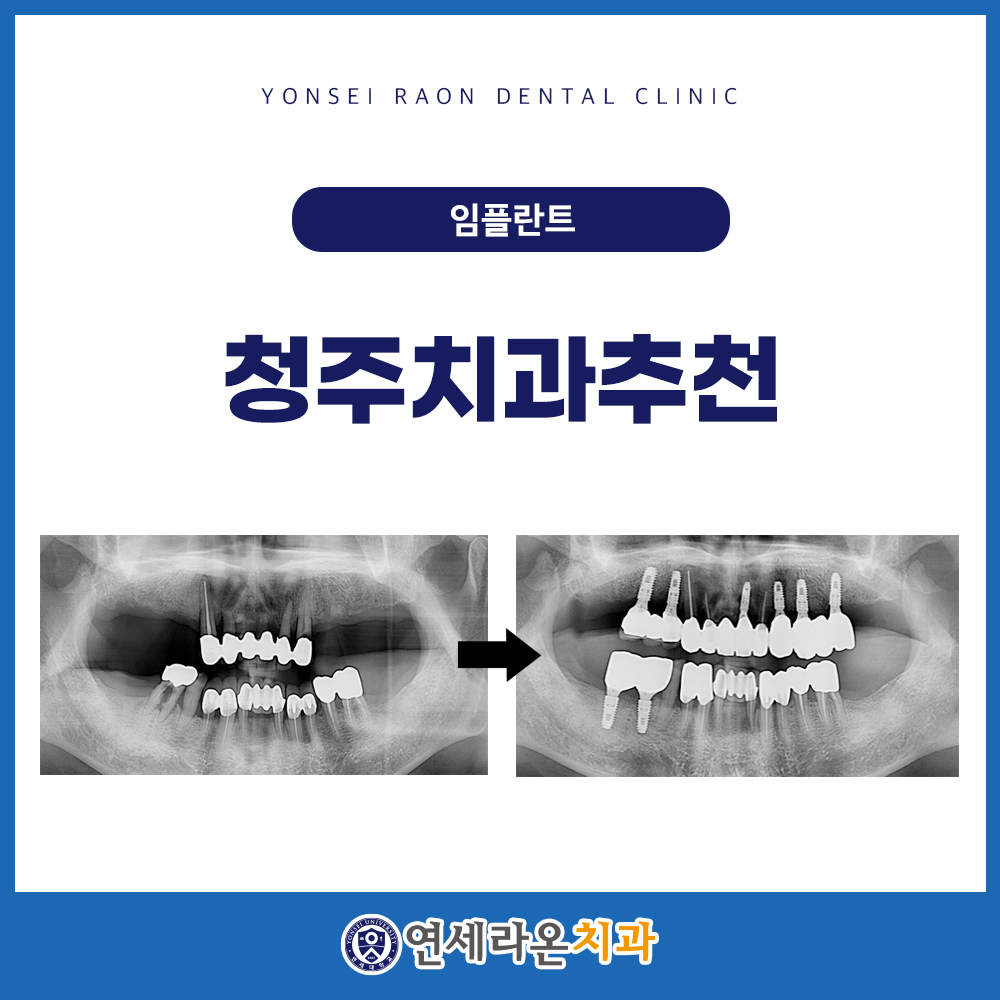 청주치과추천 