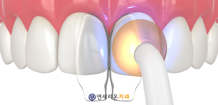 청주터미널치과