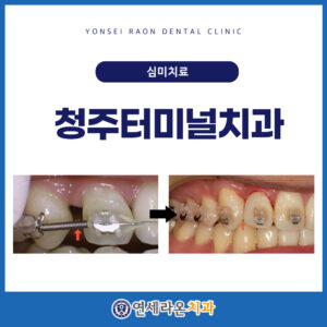 청주터미널치과