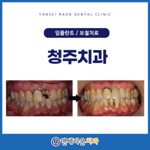 청주치과