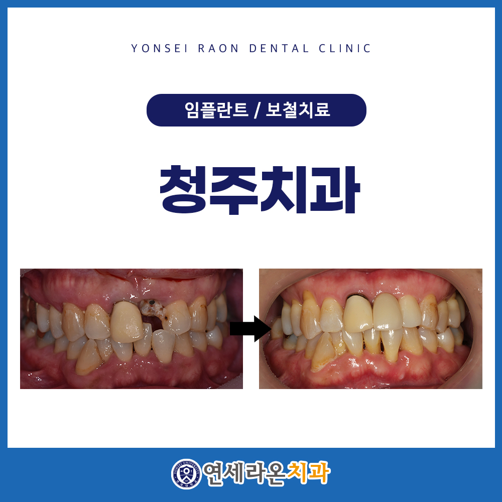 청주치과