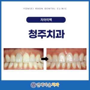 청주치과