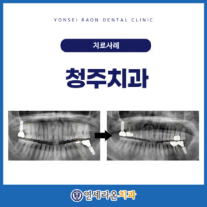 청주치과