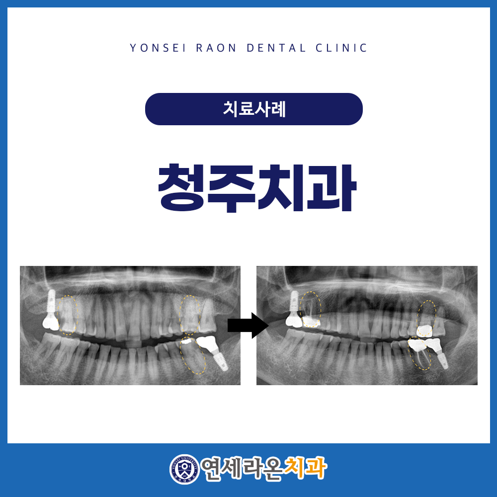 청주치과